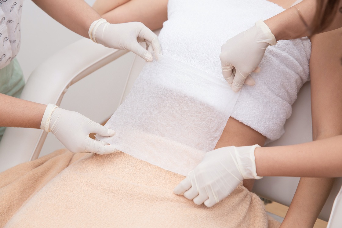 Body contouring specialist assessing treatment zones with careful measurement and planning