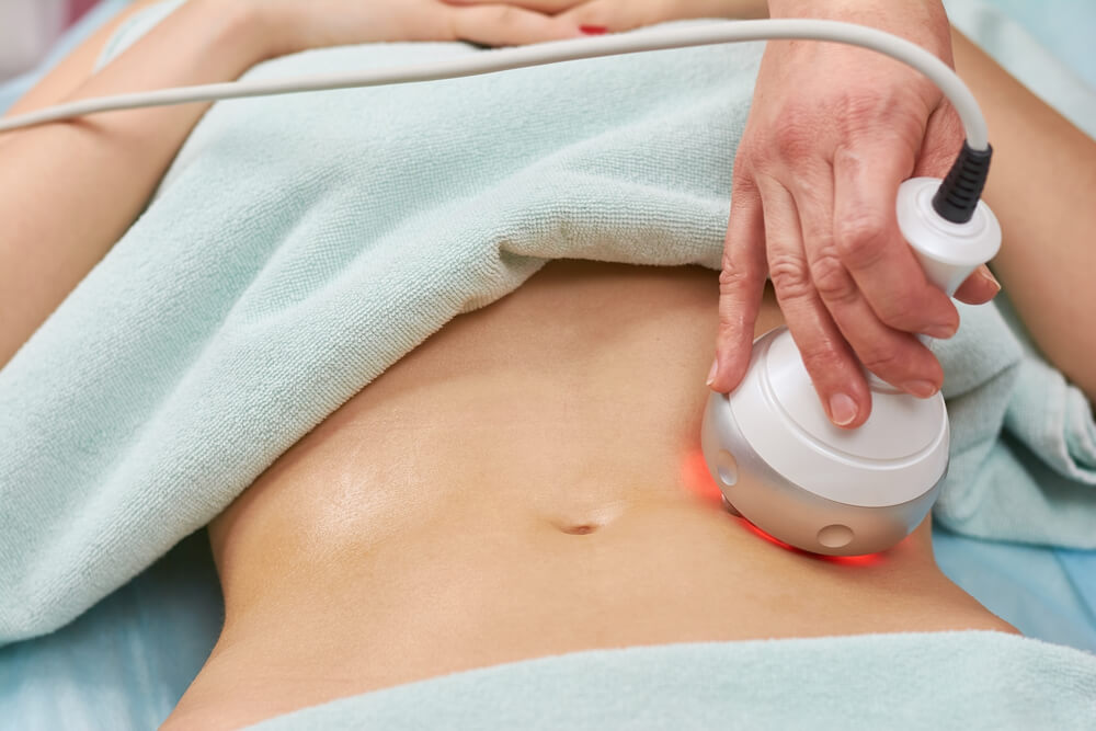 Client receiving noninvasive body contouring treatment on abdomen before a summer event