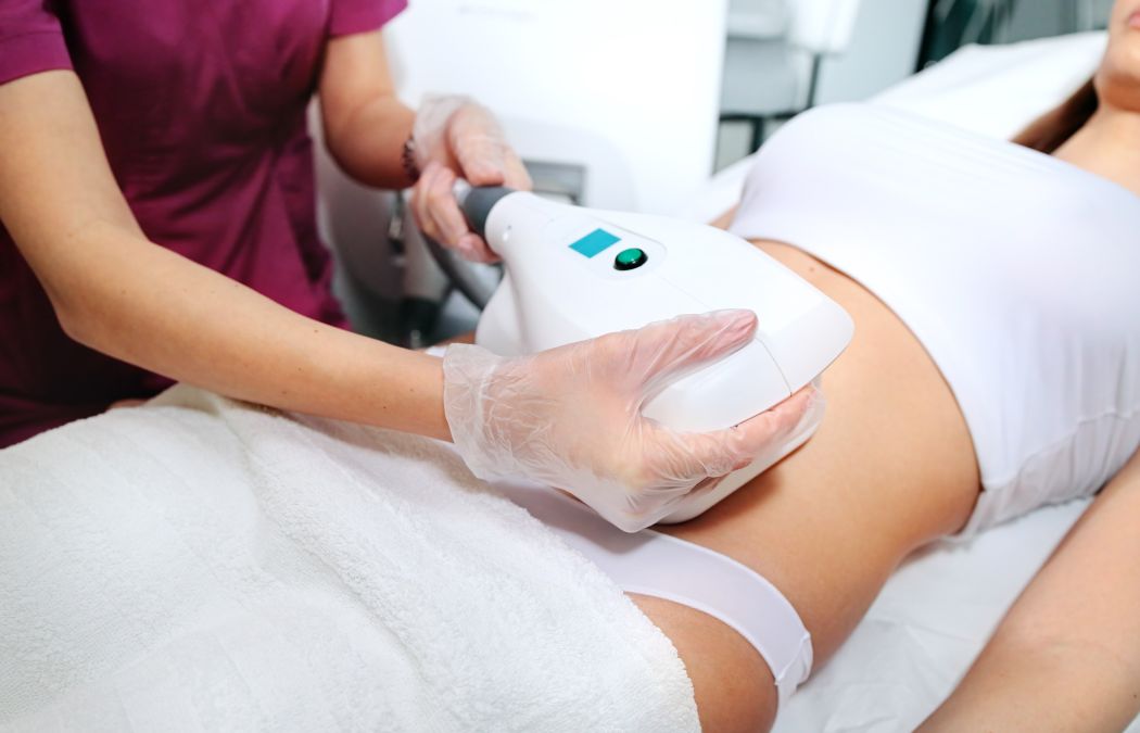 Client receiving noninvasive body contouring treatment on abdomen before a summer event