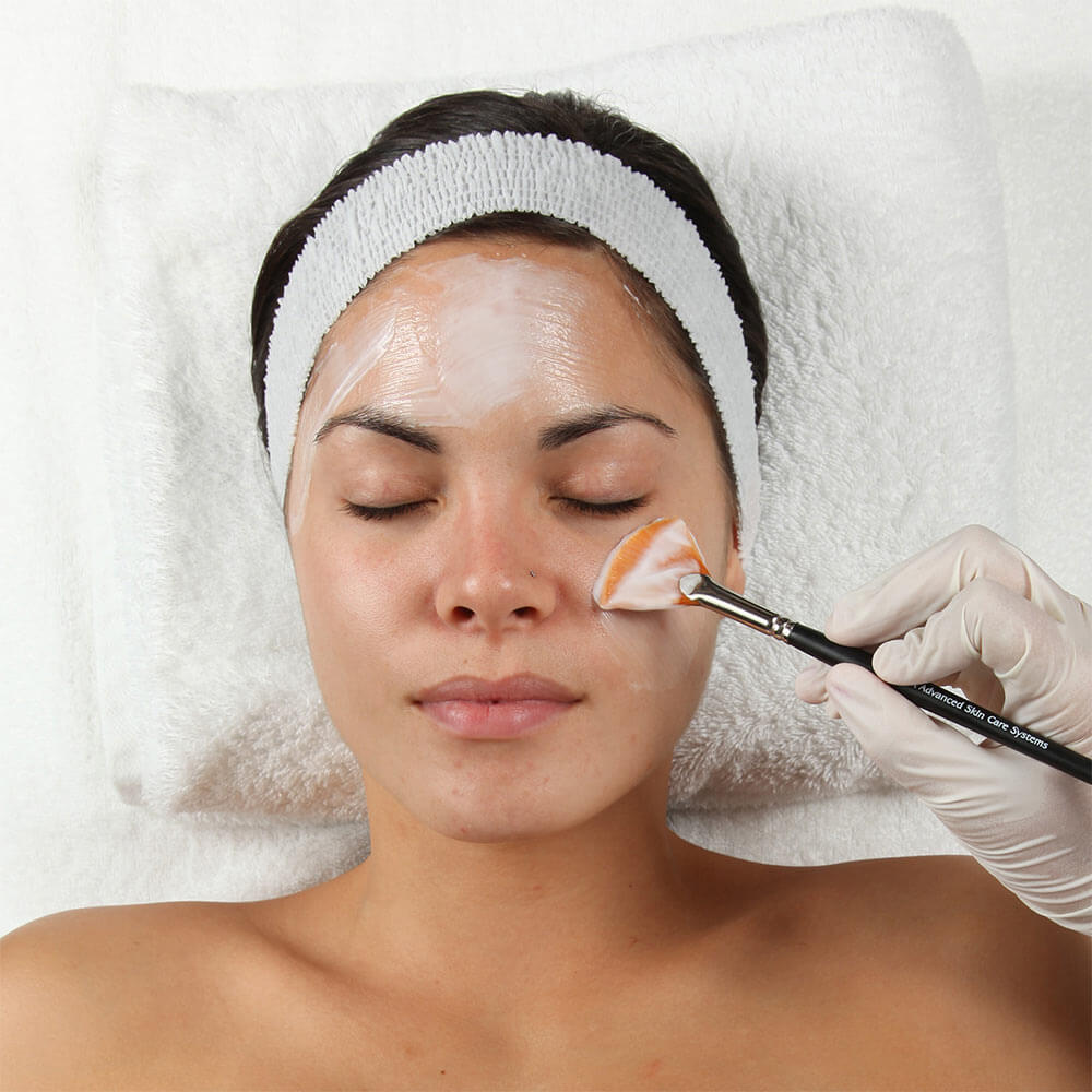 Client receiving chemical peel before a busy workweek in an Orange County treatment room